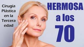 HERMOSA A LOS 70 👵🏼 Cirugías y Tratamientos De Belleza En La Tercera Edad ⭐ Dr ALBERTO CALVO QUIROZ