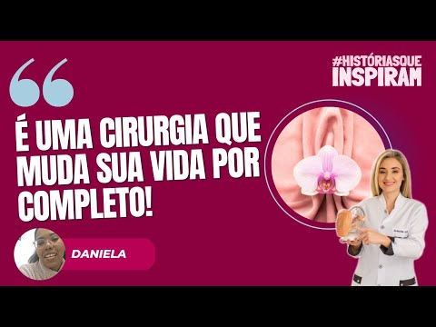 Thumbnail do vídeo