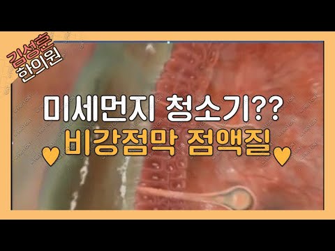 코는 미세먼지 청소기