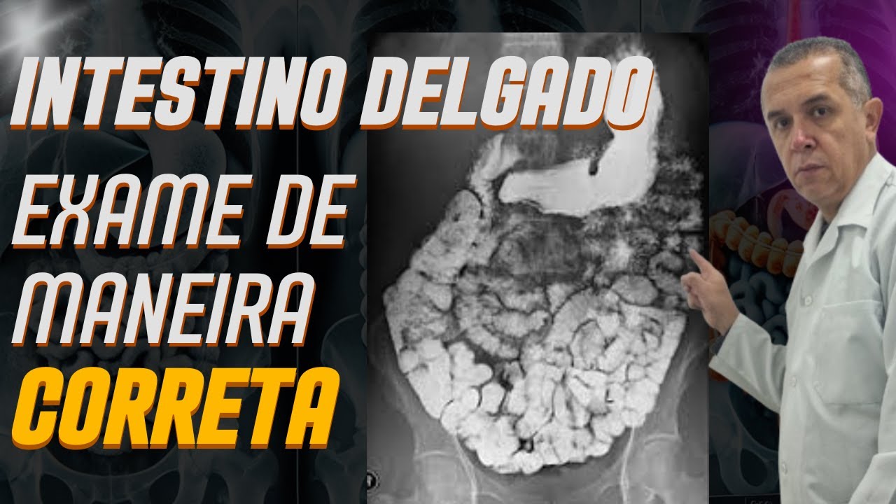 Exame Contrastado do Intestino Delgado  - Trânsito Intestinal