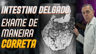 Exame Contrastado do Intestino Delgado  - Trânsito Intestinal