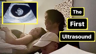 OUR FIRST ULTRASOUND - 8 Weeks Pregnant!!