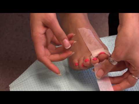 Bandaging Toes