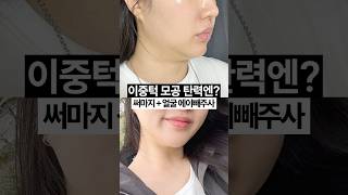 30대 피부 시술 추천 💗