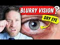 Why Dry Eyes Cause Blurry Vision - 3 Reasons, And 3 Home Remedies