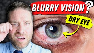 Why Dry Eyes Cause Blurry Vision - 3 Reasons, And 3 Home Remedies