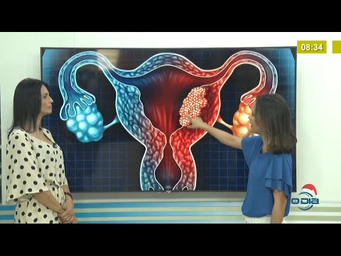 Conheça os tipos de câncer que podem afetar o útero 08 12 2020