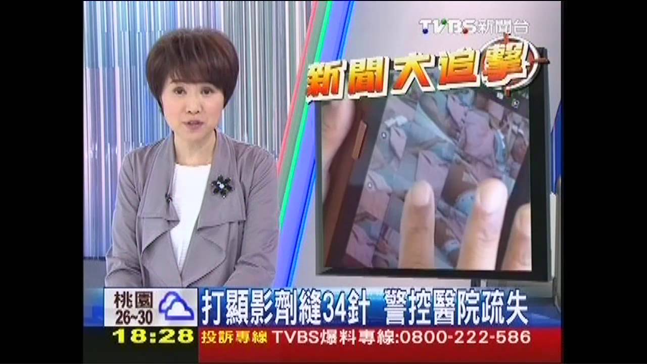 〈獨家〉打顯影劑縫34針 警控醫院疏失