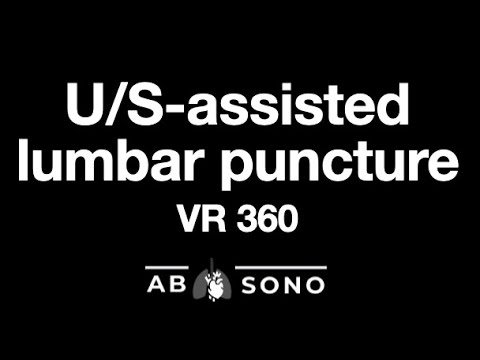 U/S-guided lumbar puncture approach