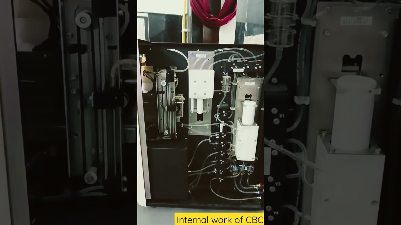 Internal work of CBC Analyser Machine #lab #cancer #motivation #bloodclottingfactor