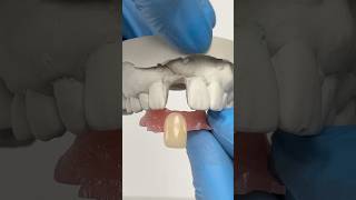 ActyGrip Flipper Partial #lsk121shorts #dentist #teeth