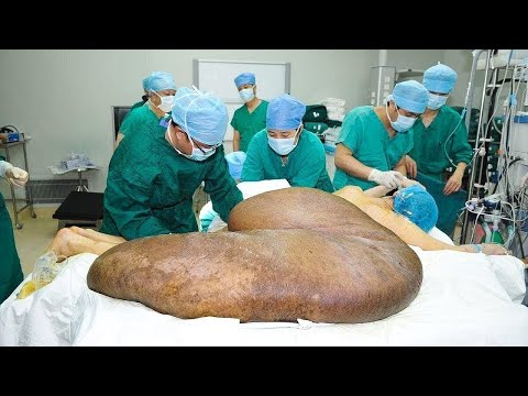 8 krasse Dinge, die in menschlichen Körpern gefunden wurden
