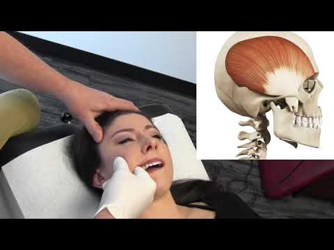 Temporal Headaches - Temporalis Muscle Internal Release Procedure - MSR Demo