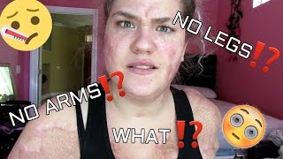 WHAT HAPPENED TO ME?! NO ARMS!? NO LEGS?!  | STORY TIME! ♡