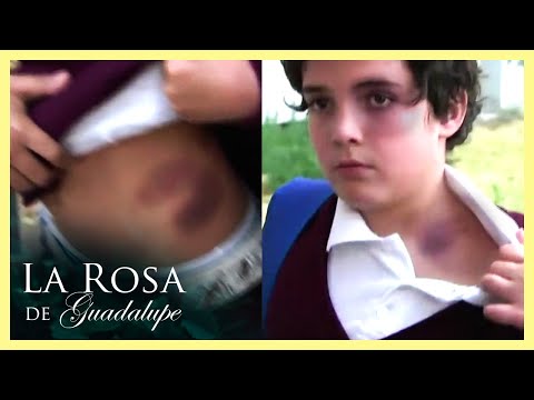 Nico y los ni&ntilde;os muestran sus golpes de agresiones | 3/3 | Sin miedo en el coraz&oacute;n