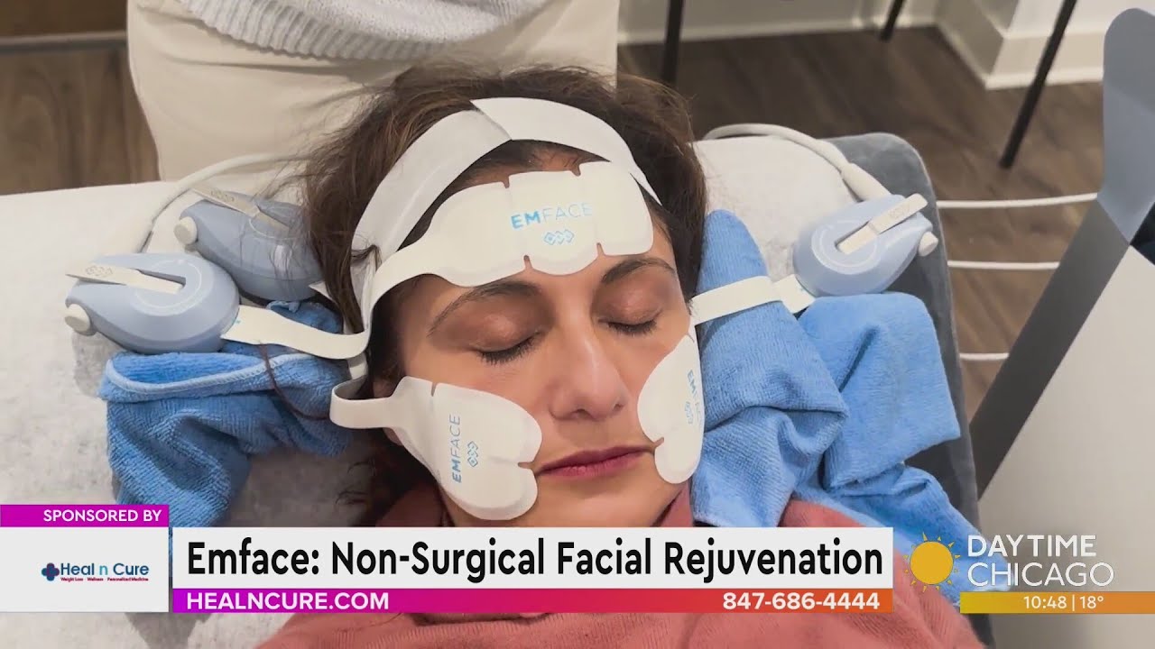 Emface: Non-Surgical Facial Rejuvenation