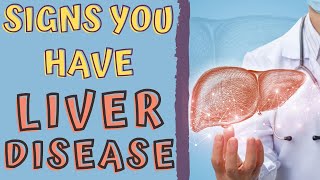 SIGNS THAT YOU HAVE A LIVER DISEASE/ liver disease signs and symptoms