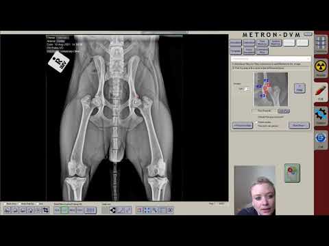 ClaroX DR System Software: Guided Mark Ups and Templates - video 5