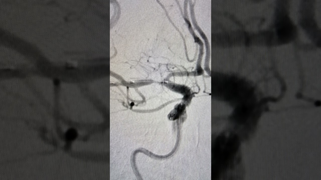 André Luis Nunes Albano De Meneses-5