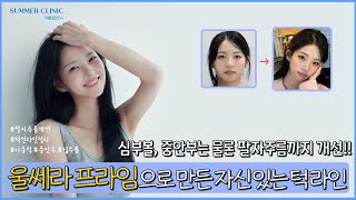 울쎄라 프라임으로 만든 자신있는 턱라인 _ 울쎄라프라임 시술 브이로그