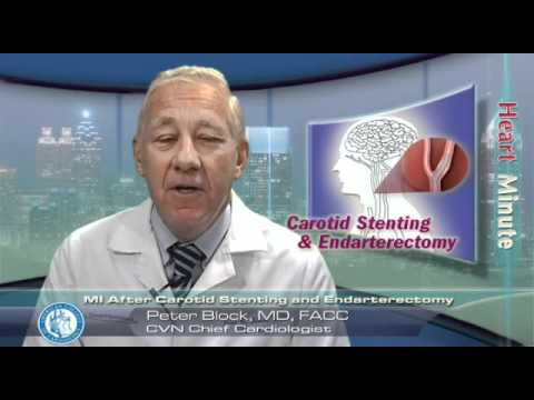 Heart Minute | MI After Carotid Stenting and Endarterectomy