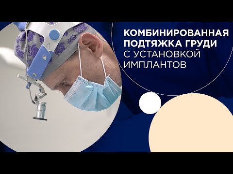 Valentin Zykov-80