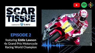 Episode 2: Eddie Lawson, 4x Grand Prix Motorcycle Racing World Champion - SCAR TISSUE Podcast