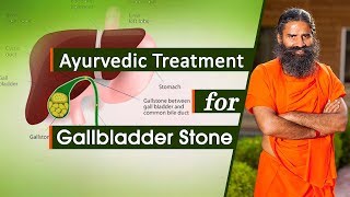 Download lagu Ayurvedic Treatment for Gallbladder Stone Swami Ra... mp3