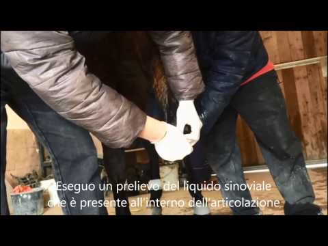 Acquistare da dolori articolari Tomografia di giunti