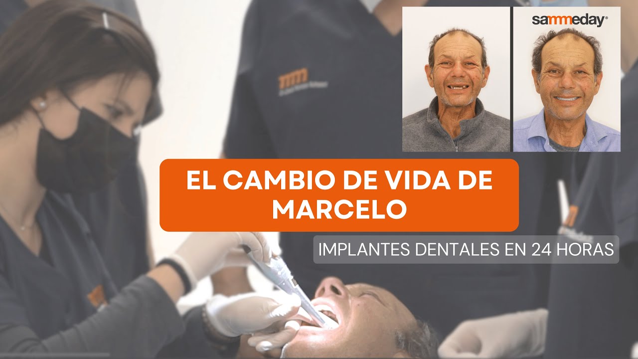 La historia de Marcelo — Técnica Sameday