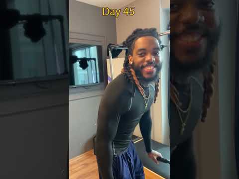 +15 cm more height with limb lengthening surgery #limblengthening #gettaller #longlegs #shorts