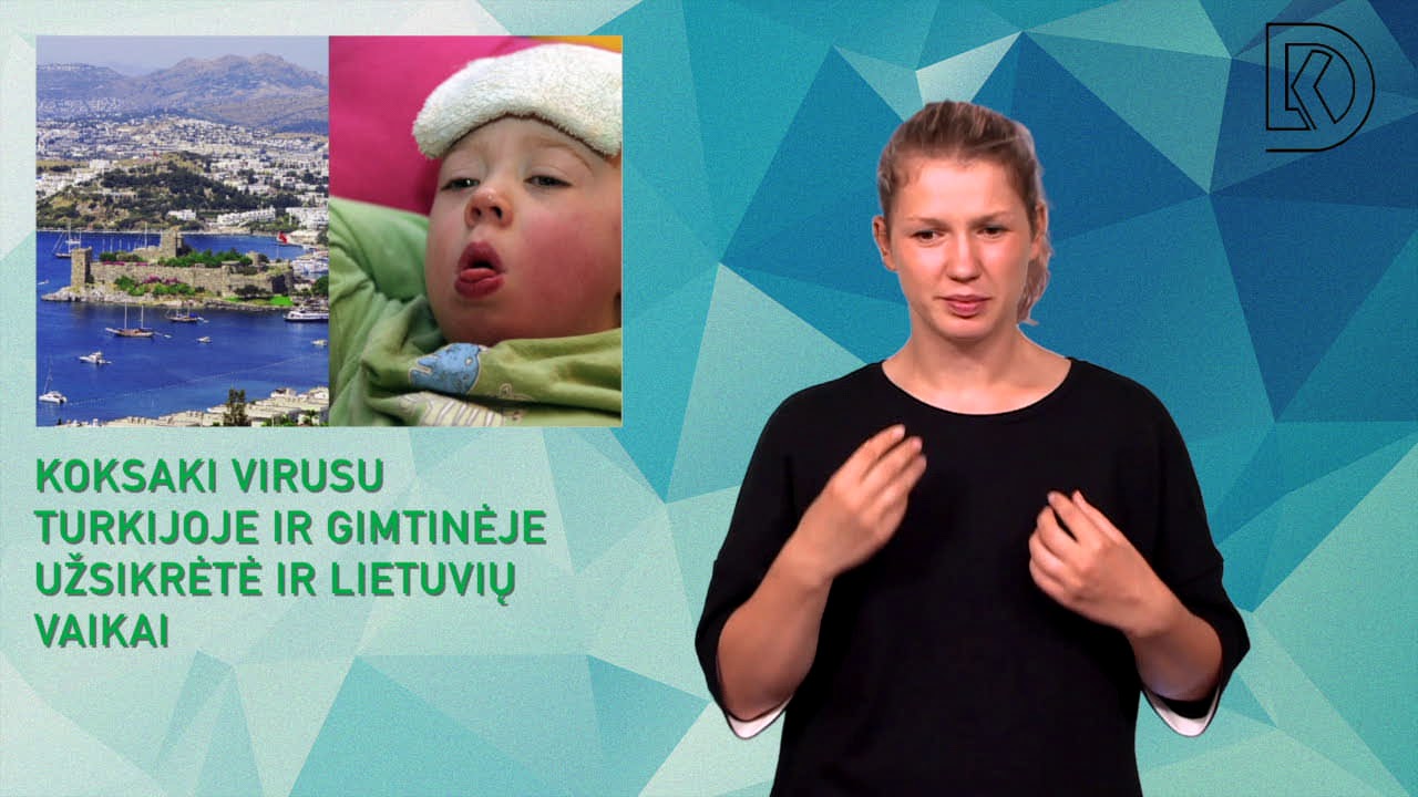 Koksaki virusu Turkijoje ir gimtinėje užsikrėtė ir lietuvių vaikai