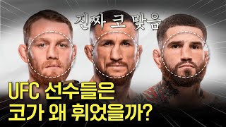 비중격 만곡증, 휜 코의 모든것 [원인과 문제, 교정까지!]