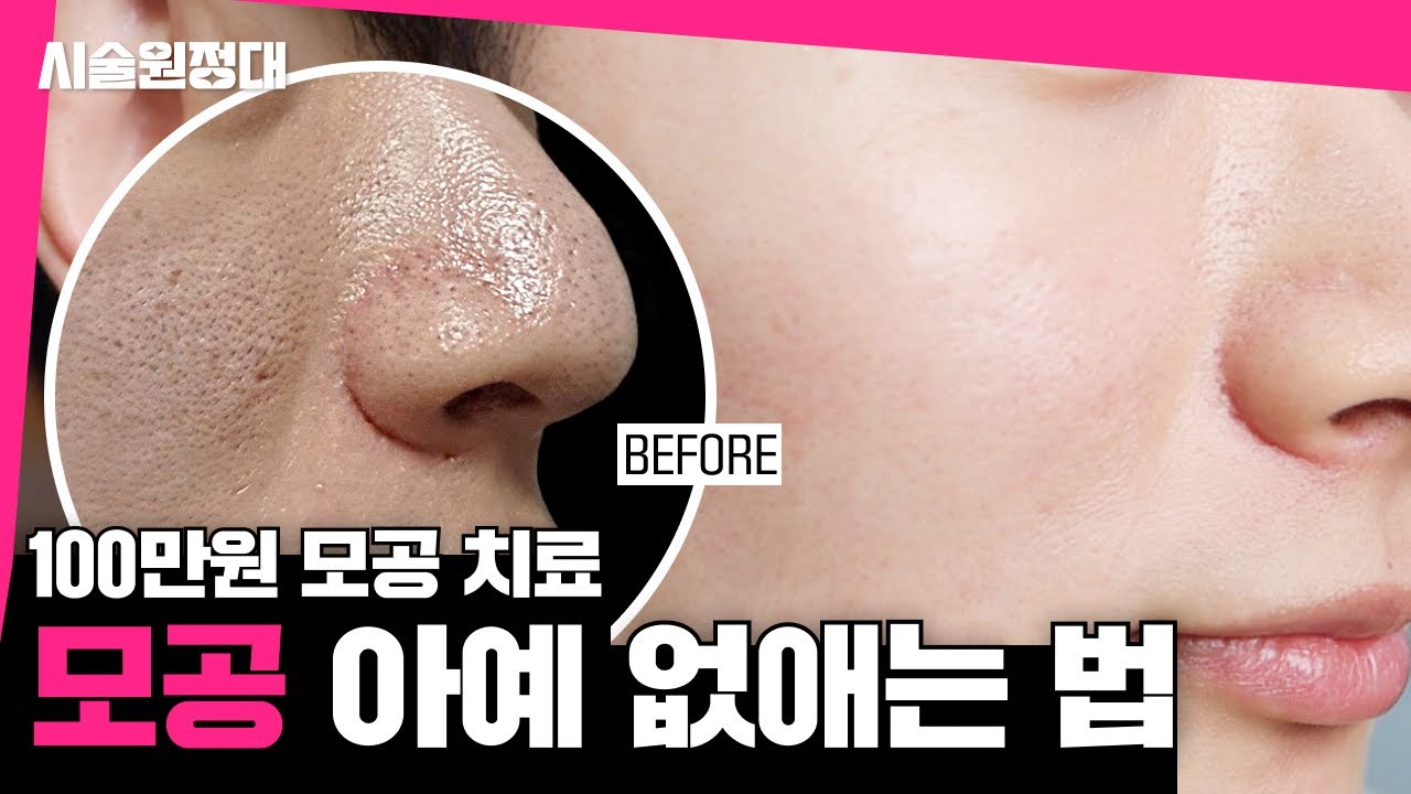 related_video_thumbnail