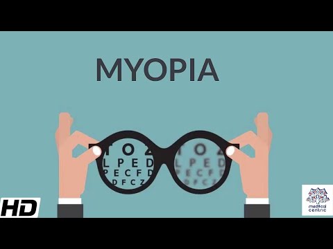 Alacsony myopia látásélesség