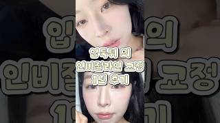 투명 교정(인비절라인)과 양악수술