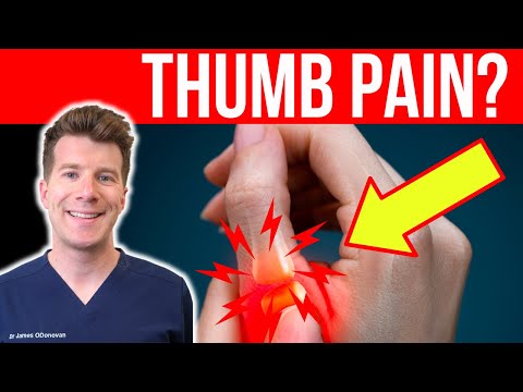 Doctor explains 8 causes of THUMB PAIN | Causes, Symptoms and Treatment