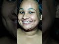 Trying Fake Dimple Hack Get Dimple In 2 Minutes Shorts Trend Dimplehack