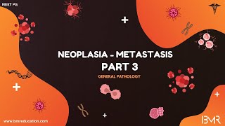 Neoplasia Part 3 | Metastasis - Routes and Mechanism | General Pathology 2025