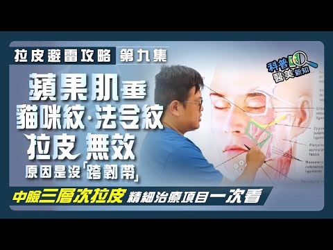 【拉皮避雷攻略|第九集】中臉拉皮手術效果差?原來是敗在沒有「跨韌帶」! 蘋果肌下垂、貓咪紋、法令紋一次改善到位就靠—耳廓短痕三層次緊顏拉皮 中臉精細治療項目大公開