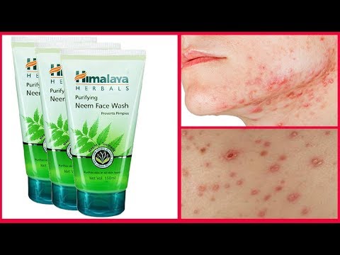 Himalaya Face Wash Acne Pimples Free Glowing Skin