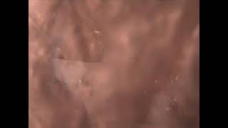 Video rabbit - r u s t l e