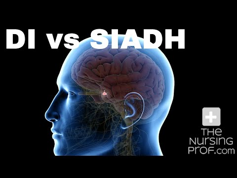 DI vs SIADH. Diabetes Insipitus (DI) vs the Syndrome of Inappropriate Antidiuretic Hormone (SIADH).