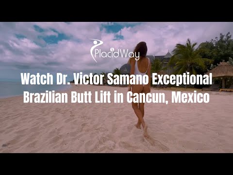 Experience the Artistry of Dr. Victor Samano's Brazilian Butt Lift in Cancun, Mexico