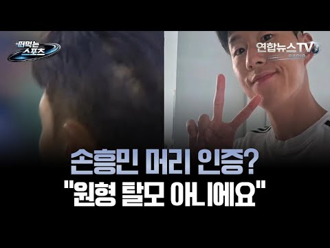 손흥민 머리 인증?....원형 탈모 아니에요 | 일본 프로야구 요미우리 아베 감독, 딸 폭행에 긴급 체포