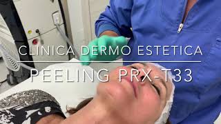 Peeling con PRX -T33