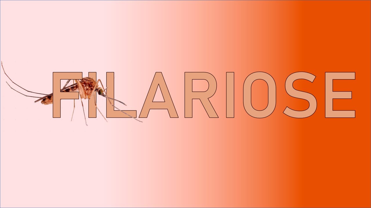 Filariose: Conhecendo uma Doença Negligenciada