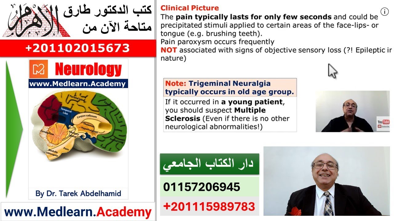 Trigeminal Neuralgia  #CME #internal_medicine #usmle   #محاضرات_باطنة