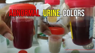 Unbelievable urine colors I seen 😱😨🙀