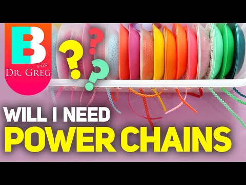 Braces Power Chains - Will I Need Them?